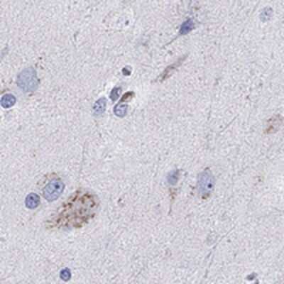 Immunohistochemistry-Paraffin: NGL-1/LRRC4C Antibody [NBP3-17662]