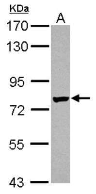 Western Blot: NGL-1/LRRC4C Antibody [NBP2-19515]