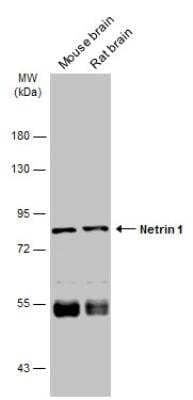 Western Blot: NGL-1/LRRC4C Antibody [NBP2-19516]