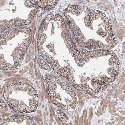 Immunohistochemistry-Paraffin: NGLY1 Antibody [NBP1-83792]