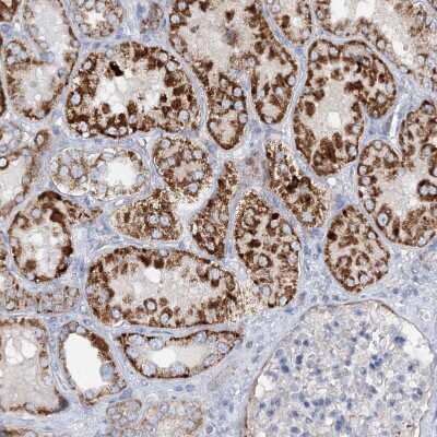 Immunohistochemistry-Paraffin: NGLY1 Antibody [NBP1-83792]