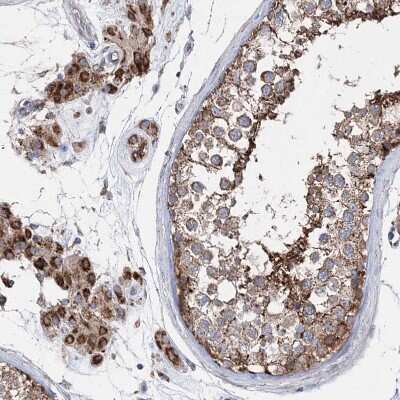 Immunohistochemistry-Paraffin: NGLY1 Antibody [NBP1-83792]