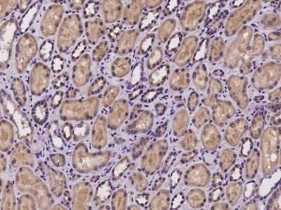 Immunohistochemistry-Paraffin: NGLY1 Antibody [NBP2-97237]