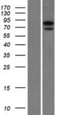 Western Blot: NGLY1 Overexpression Lysate [NBL1-13637]