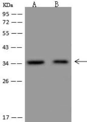 Western Blot: NGRN Antibody [NBP3-12633]