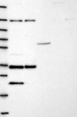 Western Blot: NGRN Antibody [NBP3-17746]