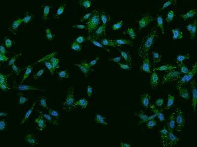 Immunocytochemistry/ Immunofluorescence: NGX6 Antibody [NBP2-98040]