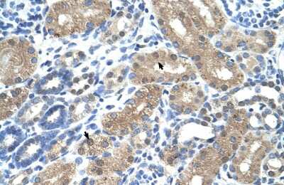 Immunohistochemistry-Paraffin: NGX6 Antibody [NBP1-60075]