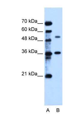 Western Blot: NGX6 Antibody [NBP1-60059]