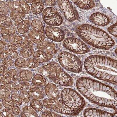 Immunohistochemistry-Paraffin: NHA2/SLC9B2/NHEDC2 Antibody [NBP2-13348]