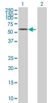 Western Blot: NHA2/SLC9B2/NHEDC2 Antibody [H00133308-B03P]