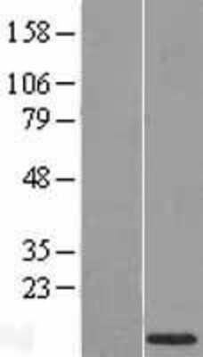 Western Blot: NHC Overexpression Lysate [NBL1-11621]