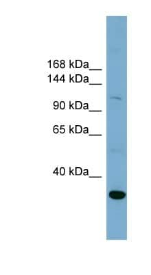 Western Blot: NHE1/SLC9A1 Antibody [NBP1-62408]