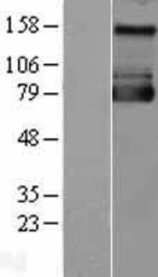 Western Blot: NHE1/SLC9A1 Overexpression Lysate [NBL1-16195]