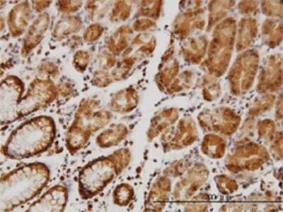 Immunohistochemistry-Paraffin: NHE1/SLC9A1 Antibody (2F5) [H00006548-M01]