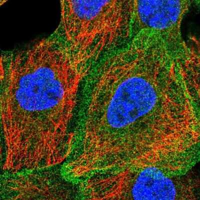 Immunocytochemistry/ Immunofluorescence: NHE1/SLC9A1 Antibody [NBP2-38683]