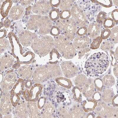 Immunohistochemistry-Paraffin: NHE1/SLC9A1 Antibody [NBP2-38584]