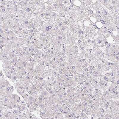 Immunohistochemistry-Paraffin: NHE1/SLC9A1 Antibody [NBP2-38584]