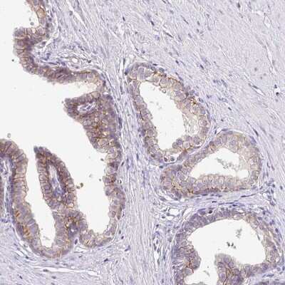 Immunohistochemistry-Paraffin: NHE1/SLC9A1 Antibody [NBP2-38584]