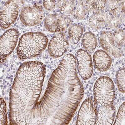Immunohistochemistry-Paraffin: NHE1/SLC9A1 Antibody [NBP2-38584]