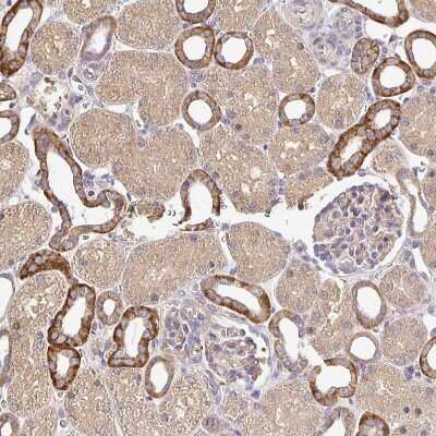 Immunohistochemistry-Paraffin: NHE1/SLC9A1 Antibody [NBP2-38683]