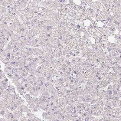 Immunohistochemistry-Paraffin: NHE1/SLC9A1 Antibody [NBP2-38683]