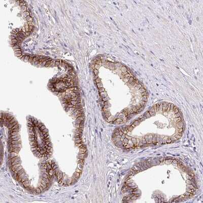 Immunohistochemistry-Paraffin: NHE1/SLC9A1 Antibody [NBP2-38683]
