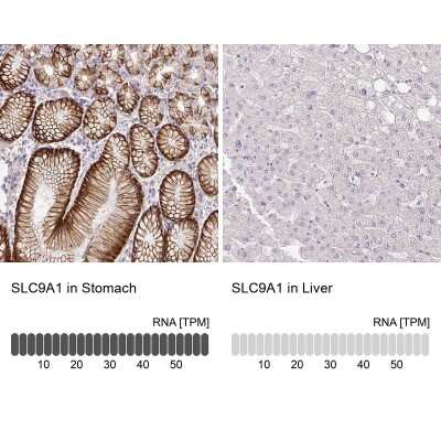 Immunohistochemistry-Paraffin: NHE1/SLC9A1 Antibody [NBP2-38683]