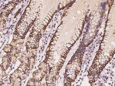 Immunohistochemistry-Paraffin: NHE1/SLC9A1 Antibody [NBP2-97304]