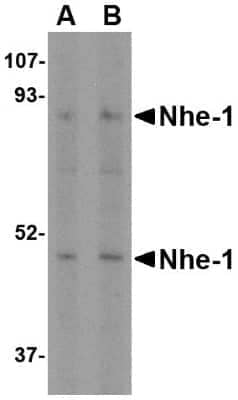 Western Blot: NHE1/SLC9A1 AntibodyBSA Free [NBP1-76847]