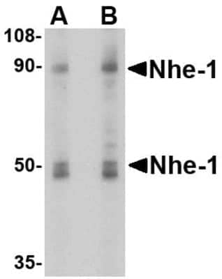 Western Blot: NHE1/SLC9A1 AntibodyBSA Free [NBP1-76848]