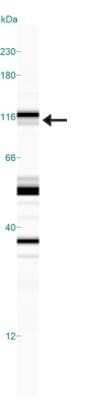 Simple Western: NHE3/SLC9A3 [p Ser552] Antibody (14D5)Azide and BSA Free [NBP2-80877]