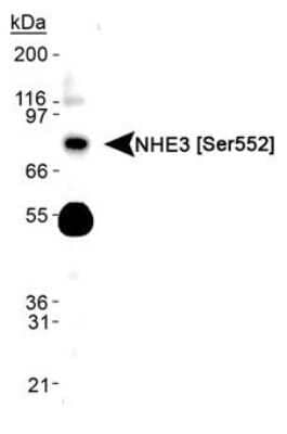 Western Blot: NHE3/SLC9A3 [p Ser552] Antibody (14D5)Azide and BSA Free [NBP2-80877]