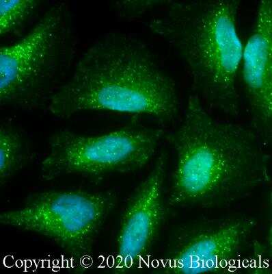Immunocytochemistry/ Immunofluorescence: NHE3/SLC9A3 Antibody - BSA Free [NBP3-00589]