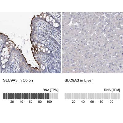 Immunohistochemistry-Paraffin: NHE3/SLC9A3 Antibody [NBP1-82574]