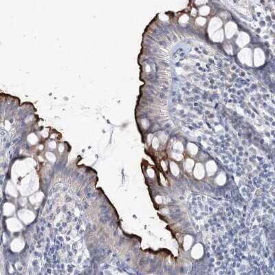 Immunohistochemistry-Paraffin: NHE3/SLC9A3 Antibody [NBP1-82574]