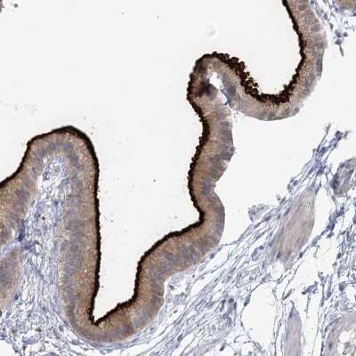 Immunohistochemistry-Paraffin: NHE3/SLC9A3 Antibody [NBP1-82574]