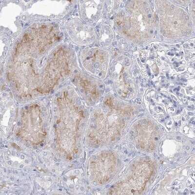 Immunohistochemistry-Paraffin: NHE3/SLC9A3 Antibody [NBP1-82574]