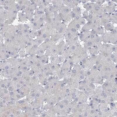 Immunohistochemistry-Paraffin: NHE3/SLC9A3 Antibody [NBP1-82574]