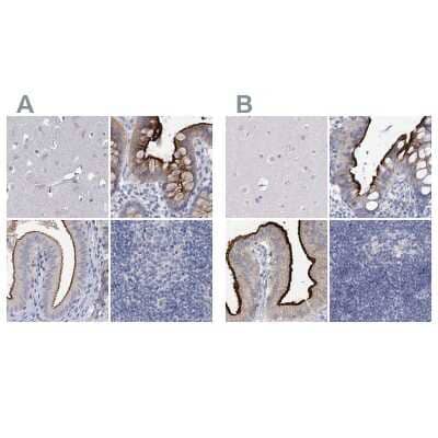 Immunohistochemistry-Paraffin: NHE3/SLC9A3 Antibody [NBP1-82575]