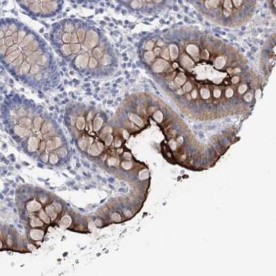 Immunohistochemistry-Paraffin: NHE3/SLC9A3 Antibody [NBP1-82575]