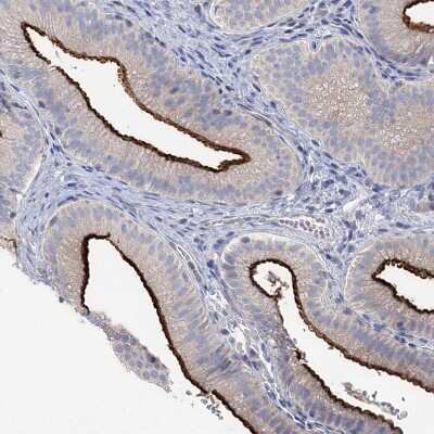 Immunohistochemistry-Paraffin: NHE3/SLC9A3 Antibody [NBP1-82575]