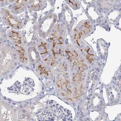 Immunohistochemistry-Paraffin: NHE3/SLC9A3 Antibody [NBP1-82575]