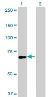 Western Blot: NHE6/SLC9A6 Antibody (2D5) [H00010479-M02]