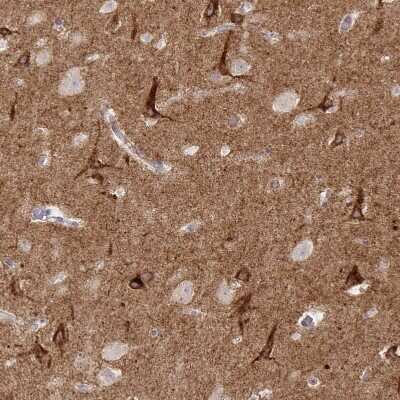 Immunohistochemistry-Paraffin: NHE6/SLC9A6 Antibody [NBP2-32463]