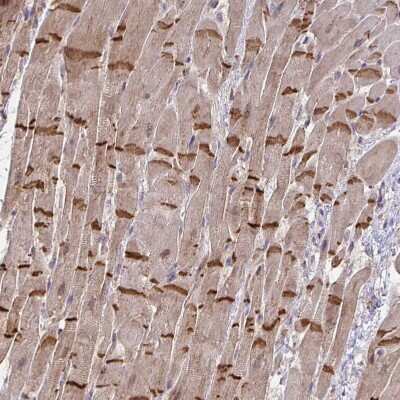Immunohistochemistry-Paraffin: NHE6/SLC9A6 Antibody [NBP2-32463]