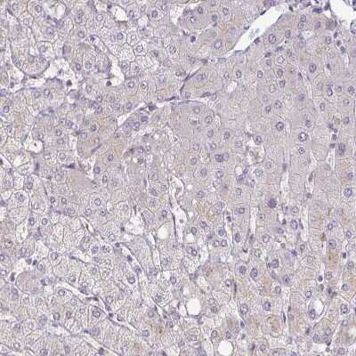 Immunohistochemistry-Paraffin: NHE6/SLC9A6 Antibody [NBP2-32463]