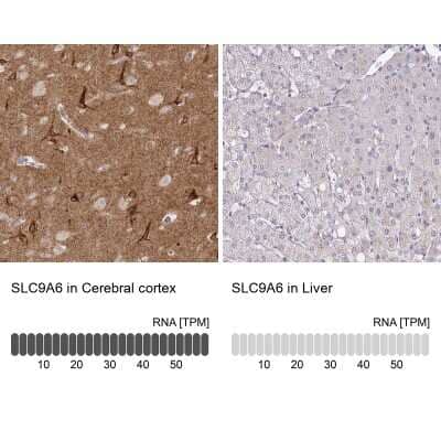 Immunohistochemistry-Paraffin: NHE6/SLC9A6 Antibody [NBP2-32463]