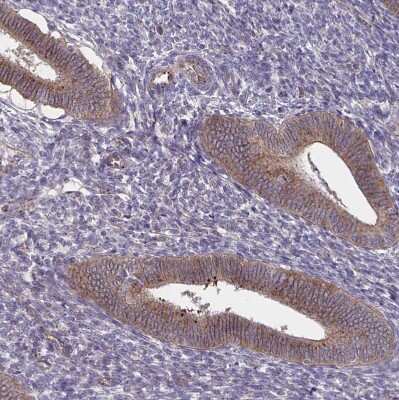 Immunohistochemistry-Paraffin: NHE6/SLC9A6 Antibody [NBP2-38877]