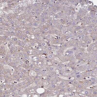 Immunohistochemistry-Paraffin: NHE6/SLC9A6 Antibody [NBP2-38877]